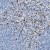 Immunohistochemistry-Paraffin: MMP8 Antibody [NBP1-85577] Immunohistochemical staining of human spleen shows strong cytoplasmic positivity in subsets of cells in the red pulp.